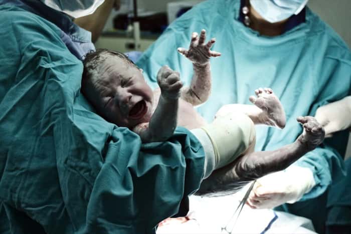 Dr Jesse Bennett of Edom, Virginia, performs 1st successful Cesarean section operation in the US on his wife