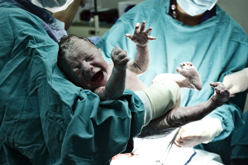 Dr Jesse Bennett of Edom, Virginia, performs 1st successful Cesarean section operation in the US on his wife